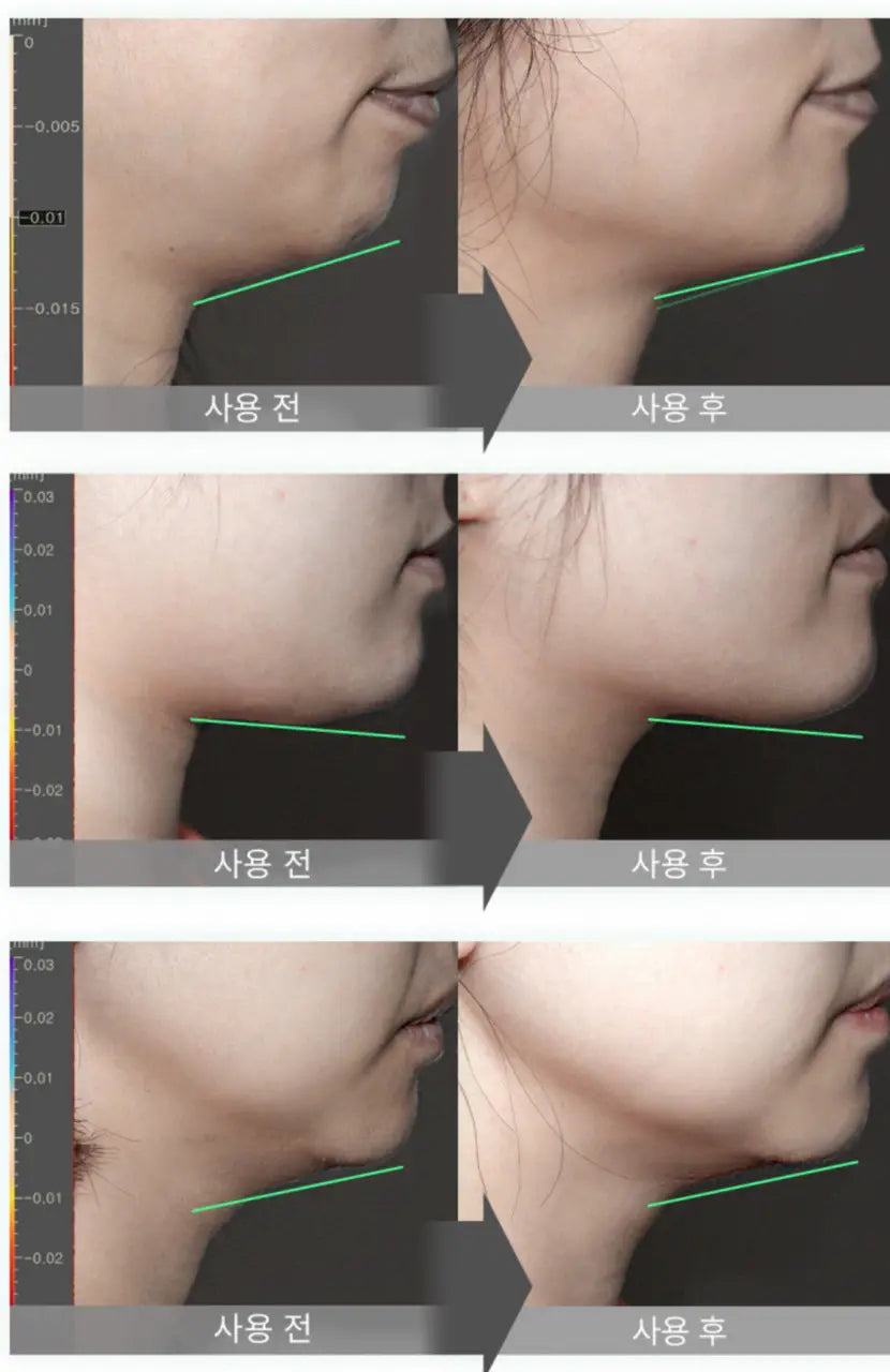 Bravity Effectra Medics Shaper [Bulsa Massage]