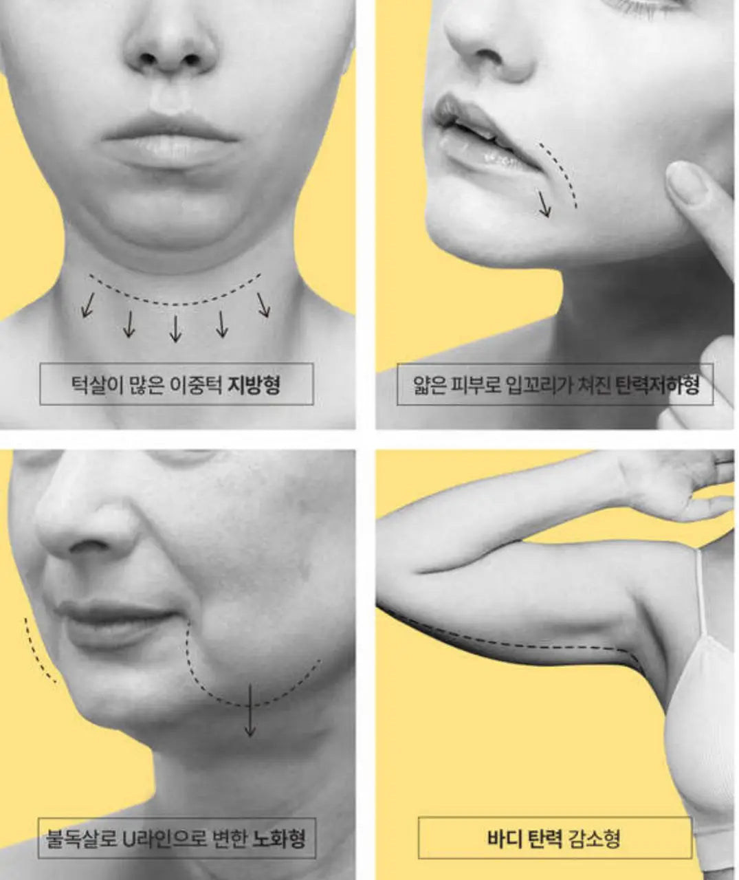 Bravity Effectra Medics Shaper [Bulsa Massage]